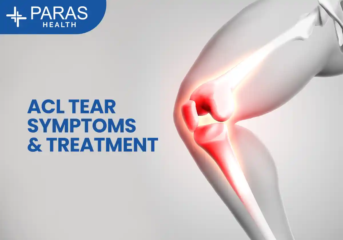 ACL Tear